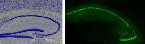 Nuevos avances en la comprensión de enfermedades neurodegenerativas que involucran convulsiones epilépticas