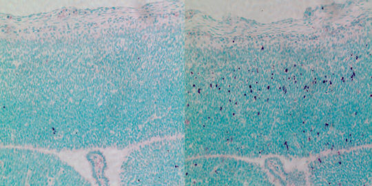 Hallan funciones clave de CEP63 en desarrollo cerebral y fertilidad