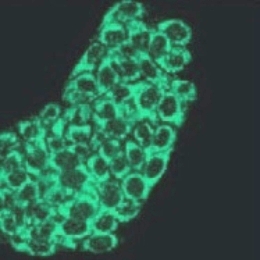 Cimera internacional sobre la biologia de les xarxes proteiques