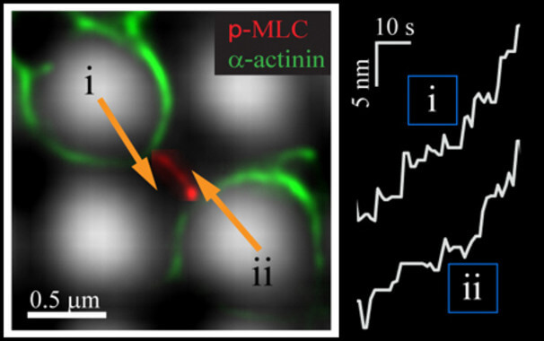 Researchers reveal a potential cancer repressor function in a key protein