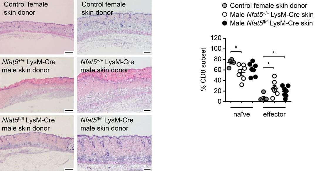 Protein NFAT5, key for communication between macrophages and lymphocytes